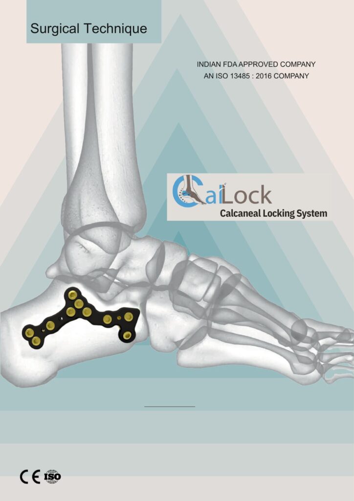 cal lock surgicaltechnique calcaneal plating system (with content).pdf